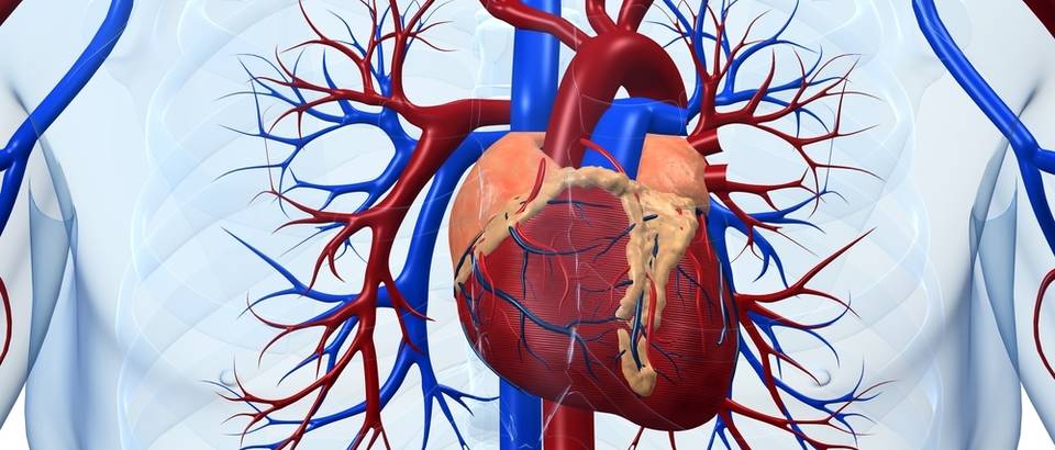 Srčani udar (infarkt miokarda) – uzroci, simptomi i liječenje